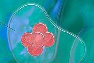 沈阳盛京三代试管需要多少费用？