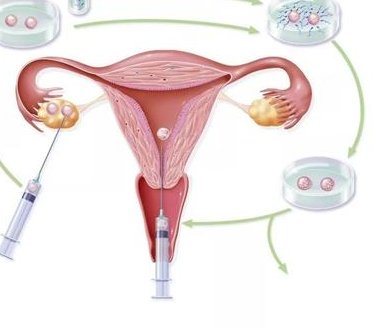 2026龙岩市最新男性陪产假有多少天？试管婴儿可以增加产假吗？